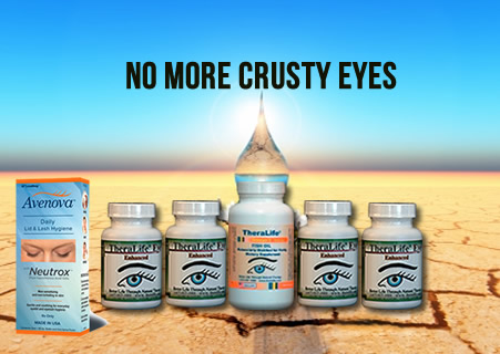 crusty eyes blepharitis eye natural