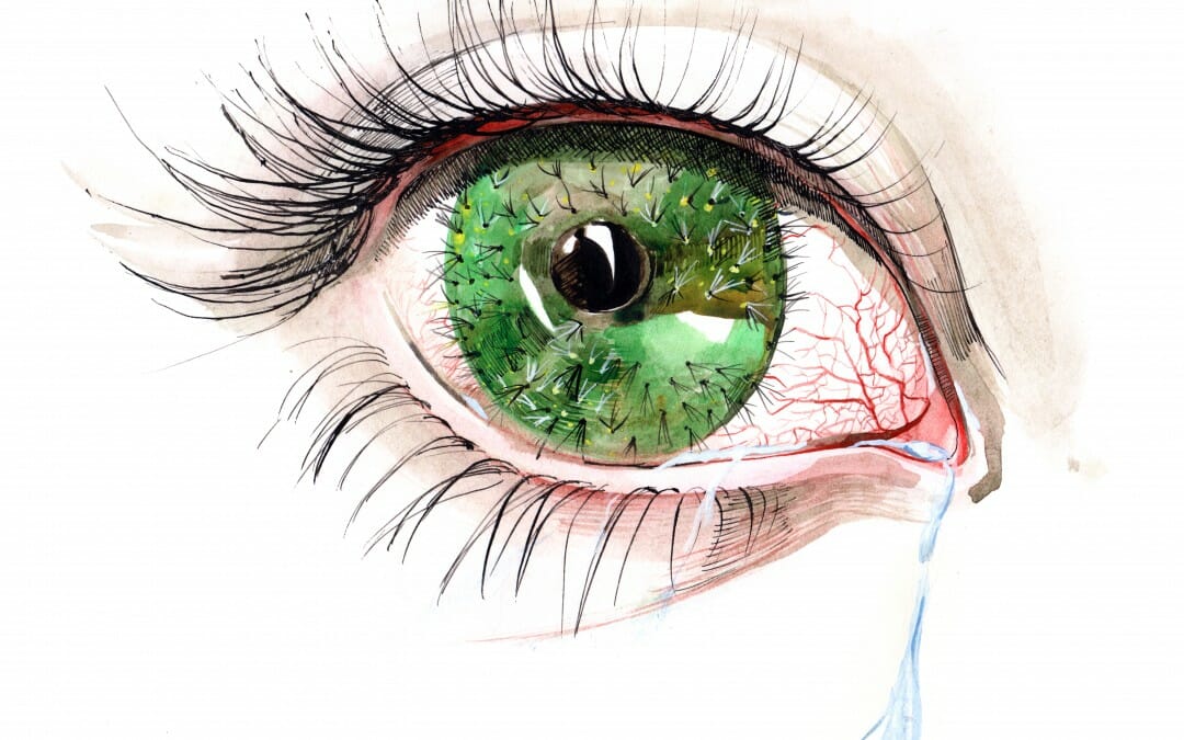 Cure Dry Eyes & Seasonal Allergies Now