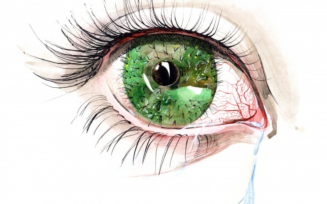 Stop Eye Pain Caused By Dry Eyes?