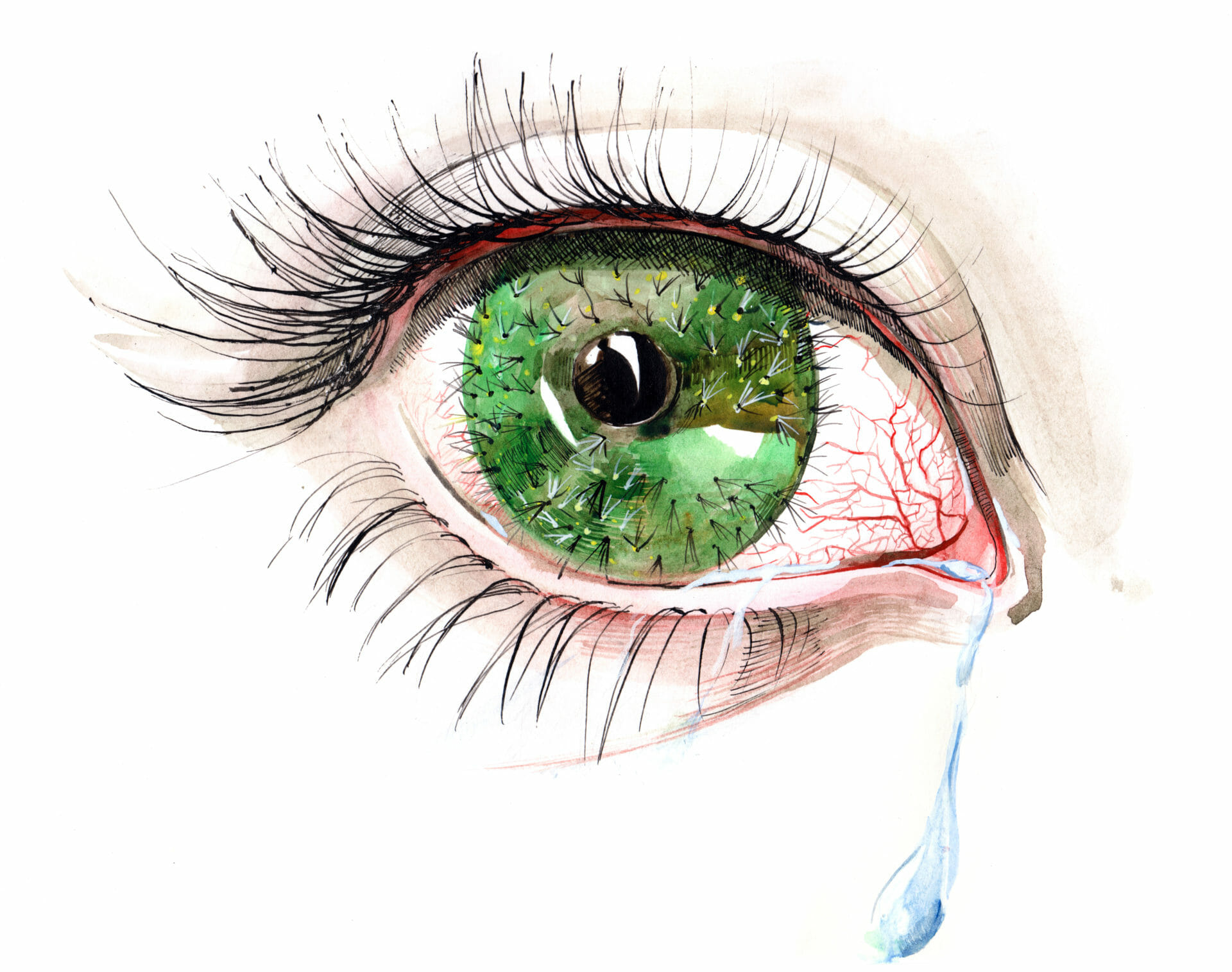 Dry Eye Artwork