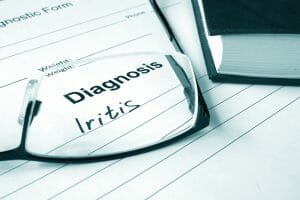 Iritis diagnosis