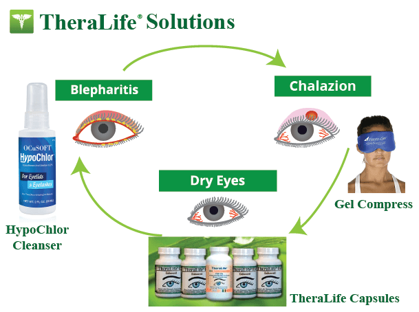 TheraLife Solution Chalazion v2