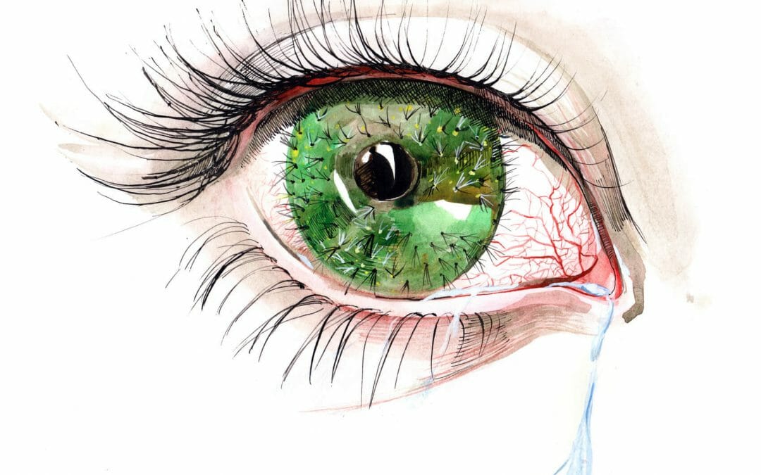 Dry Eye Treatment – For Red Irritated Dry Eyes