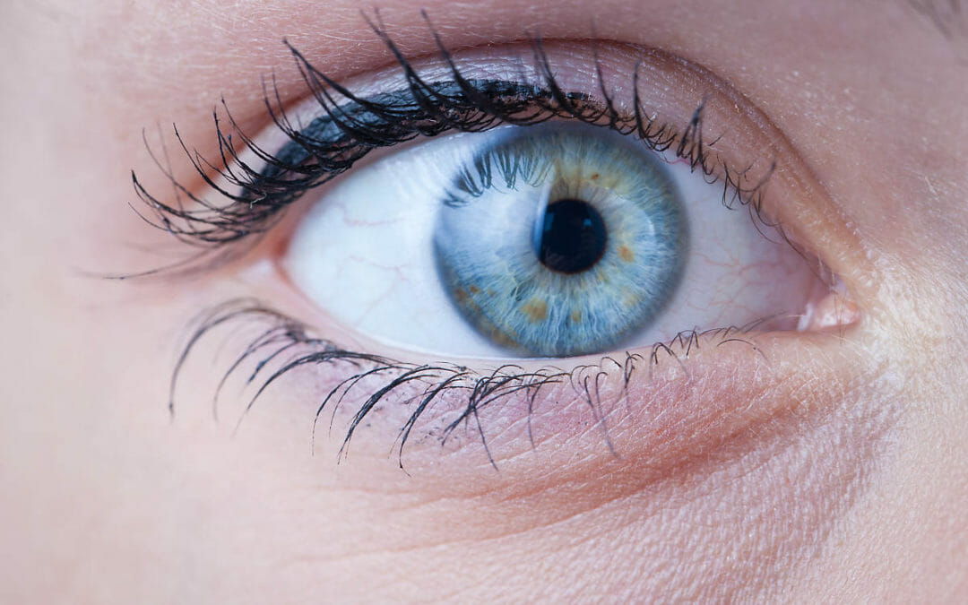 Blepharitis Vs. Stye: Battle Of The Eye Conditions – What’s The Real Difference?