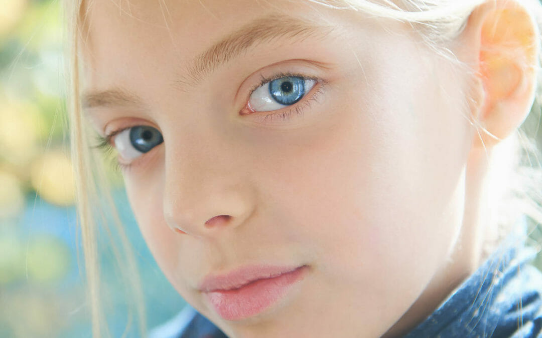 Acne Rosacea eyes – Ocular Rosacea Treatments