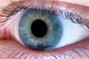 rheumatoid arthritis eye