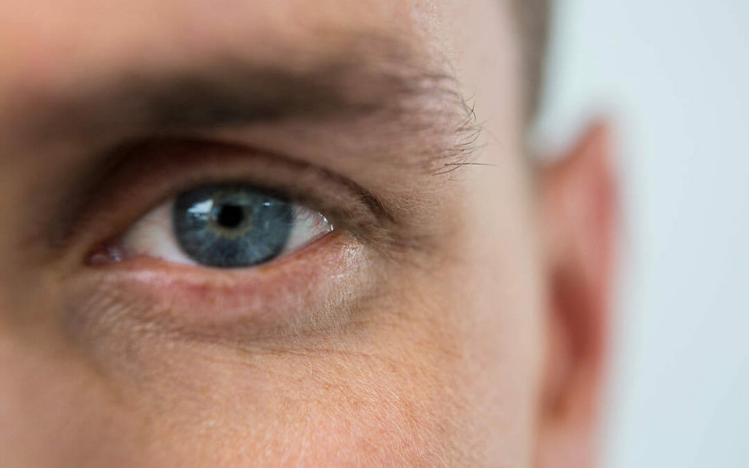 Incredible Itchy Eyes- Symptoms, Causes and Treatments