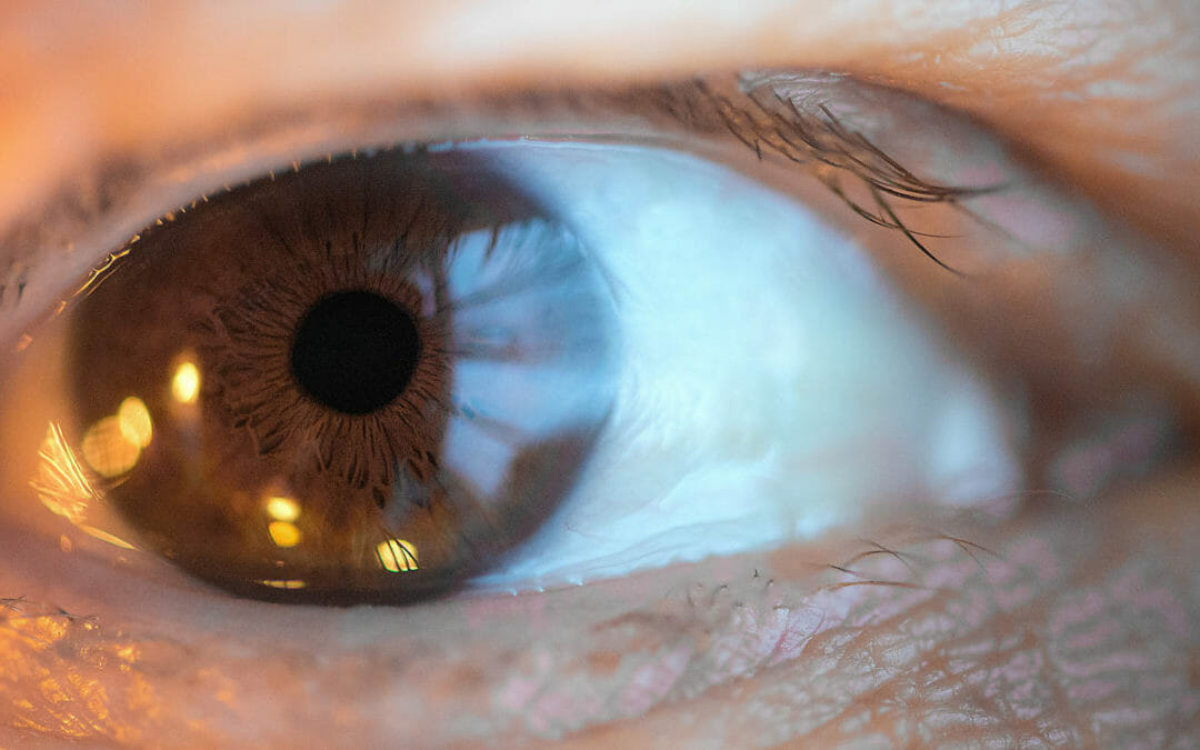 Posterior Uveitis – 7 Key Symptoms & Diagnosis