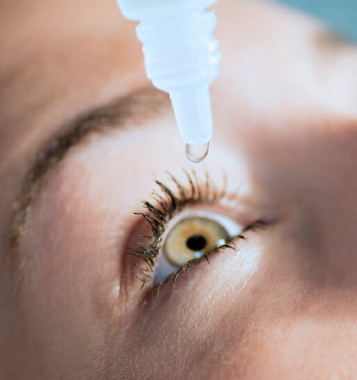 Amazing Itchy Eyes Treatments